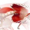PSOAS, “EL MÚSCULO DEL ALMA” Conocé la importancia de su función en nuestro cuerpo